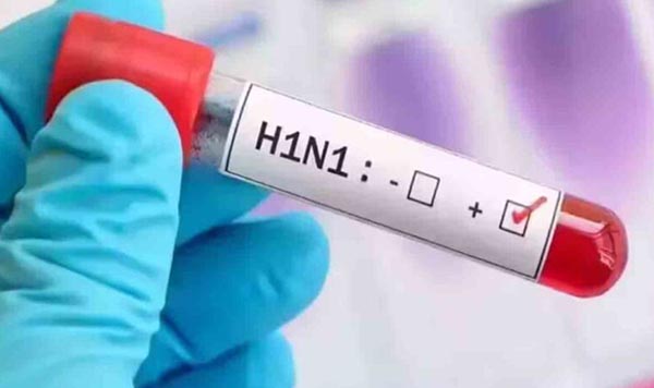 Uttarakhand Swine Flu